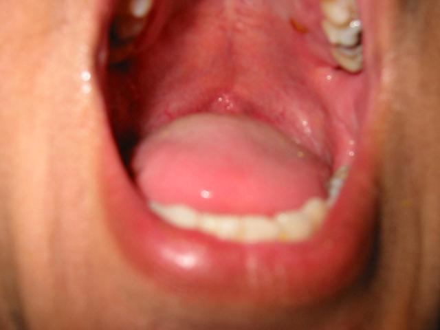 176-7696_IMG.jpg